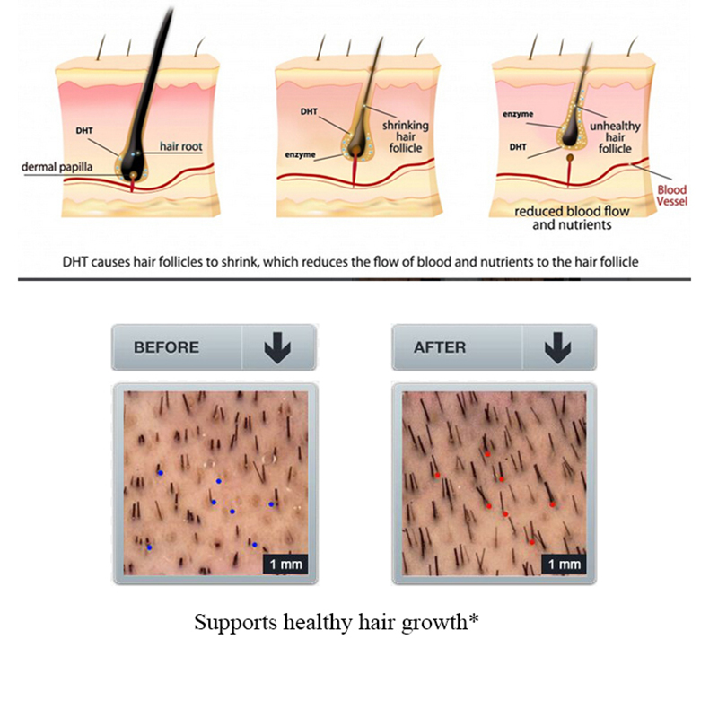 PURC Ginger Hair Loss Shampoo  - Licorice Root Sticks ulasan dan harga