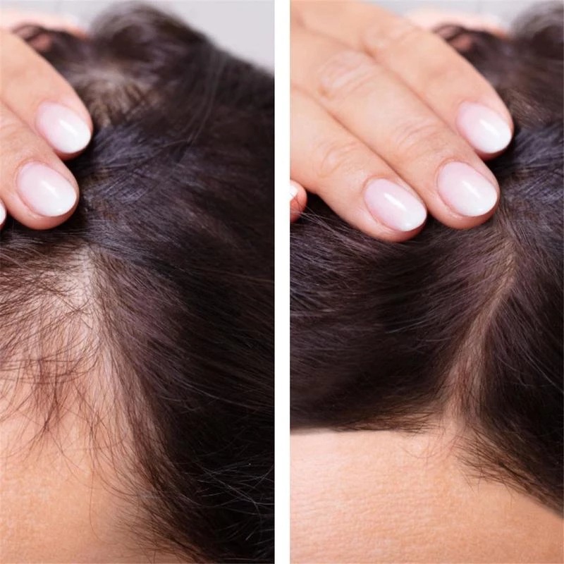 2023 Biotin Fast Hair Growth O - Licorice Root Sticks ulasan dan harga